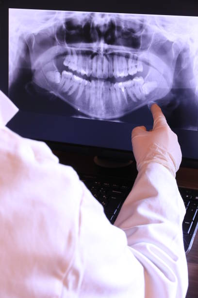 Best Emergency Tooth Extraction in Granville, OH